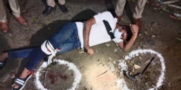 शातिर लुटेरा आकाश मुठभेड़ के दौरान घायल, कई थानो की पुलिस कर रही थी उसकी तलाश