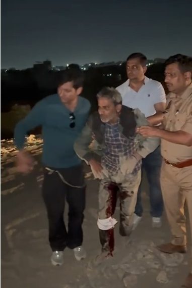 सेंट्रल नोएडा की इकोटेक 3 थाना पुलिस की 25,000 रुपये के इनामी बदमाश से मुठभेड़, बदमाश घायल